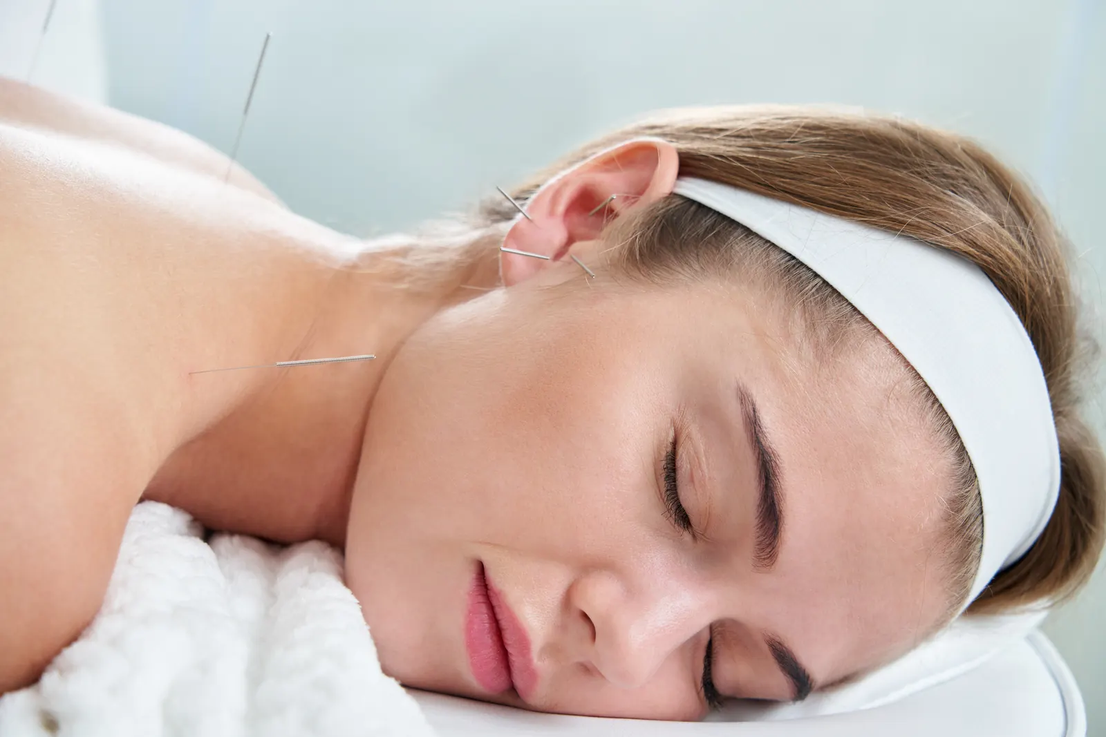 Mujer relajada, con los ojos cerrados, recibiendo acupuntura en la oreja